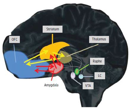 Circuit workings of OCD treatments