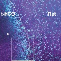 Image showing transplanted human cortical organoids made from cells taken from individuals with Timothy syndrome with immunostaining. Chen et al., Nature.